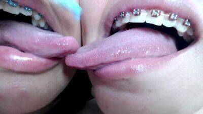 Deep tounge kissing between two brace lesbian on youpornvideos.one